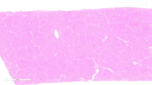 Pincha en la imagen para ver estructura de los lobulillos hepáticos